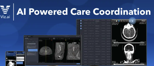 Emergency Medical AI Tools: Viz.ai's Revolutionary Stroke Detection Platform