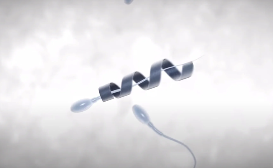 Sperm Supercharge: How Nanorobot Assist Sperm is Revolutionizing Male Fertility